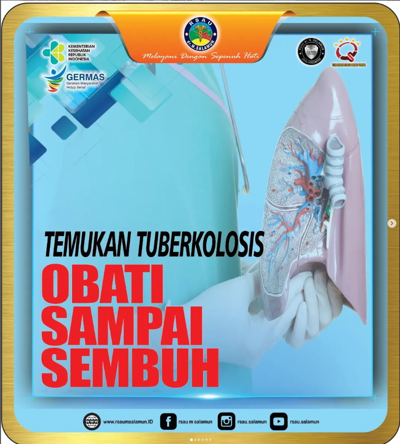 TOSS TBC: Temukan Tuberkulosis, Obati Sampai Sembuh